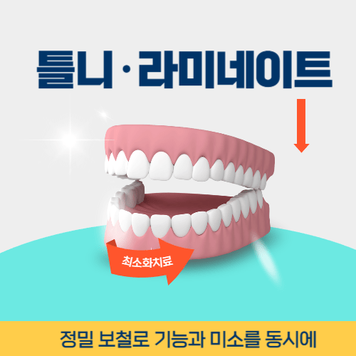 전주치과 전주시 치과 틀니 라미네이트